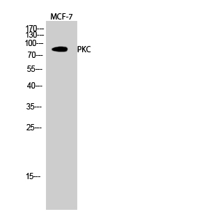 PKC Polyclonal Antibody