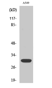 Siah/2 Polyclonal Antibody