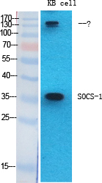 SOCS Polyclonal Antibody