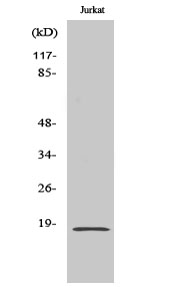 SOD Polyclonal Antibody
