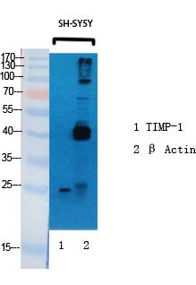 TIMP Polyclonal Antibody