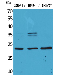 FGF2 Polyclonal Antibody
