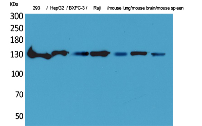 IL6 Polyclonal Antibody