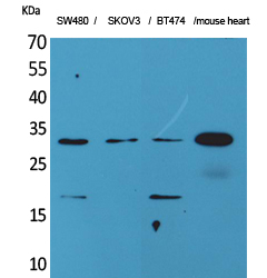FGF8 Polyclonal Antibody