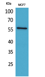 ALK Polyclonal Antibody