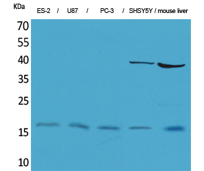 ILβ Polyclonal Antibody