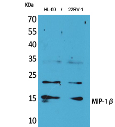 MIPβ Polyclonal Antibody
