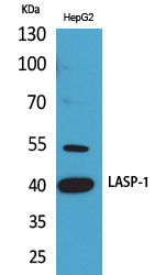 LASP Polyclonal Antibody