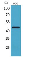 ILRII Polyclonal Antibody