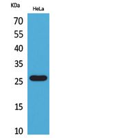 DCL Polyclonal Antibody