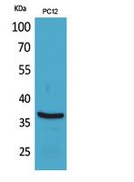 BST Polyclonal Antibody