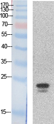 SRY Polyclonal Antibody