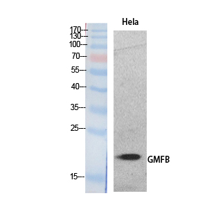 GMF-β Polyclonal Antibody