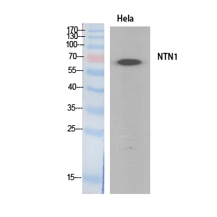 Netrin Polyclonal Antibody