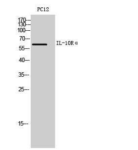 IL0Rα Polyclonal Antibody