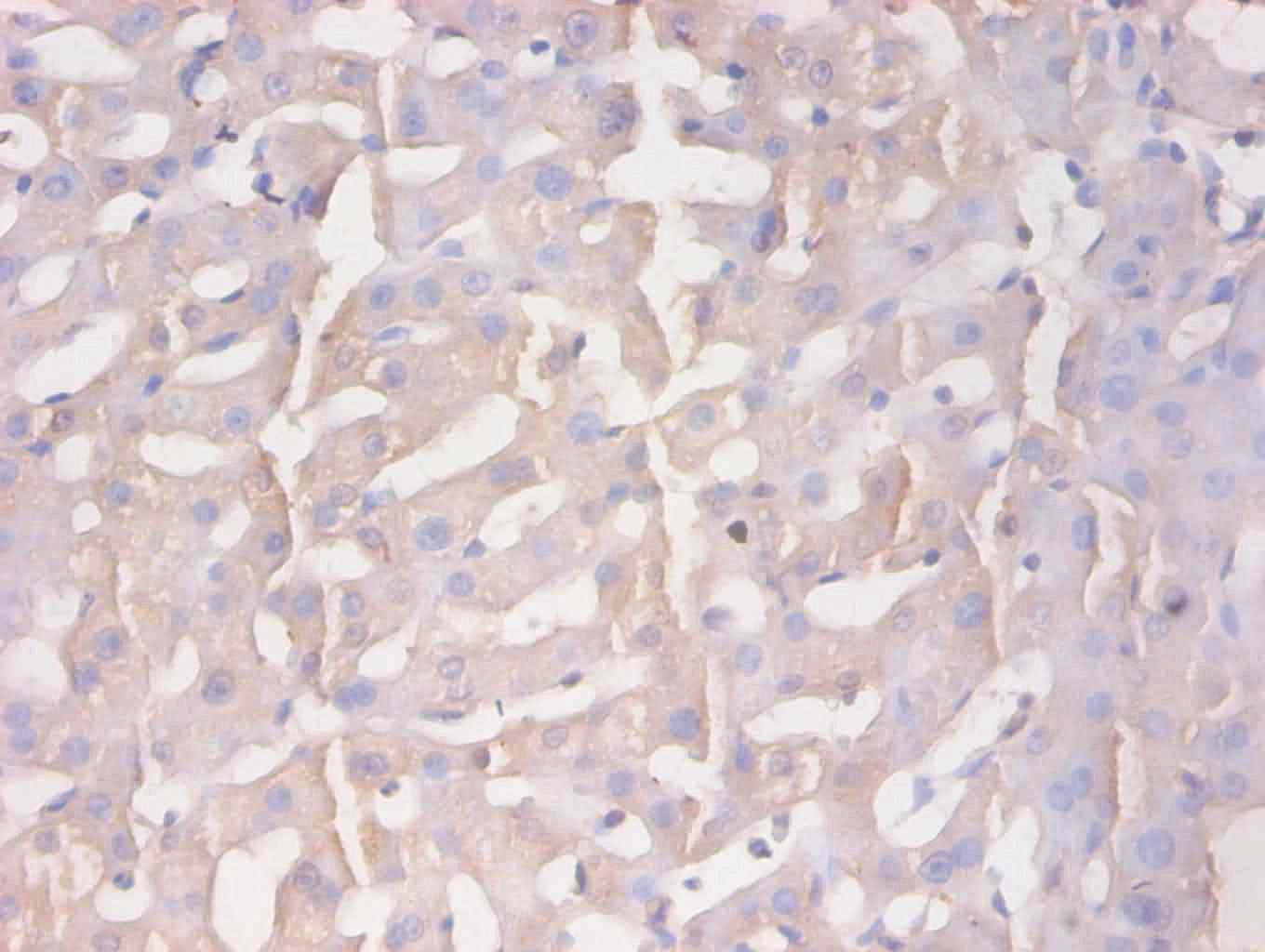 Protein AMBP Monoclonal Antibody