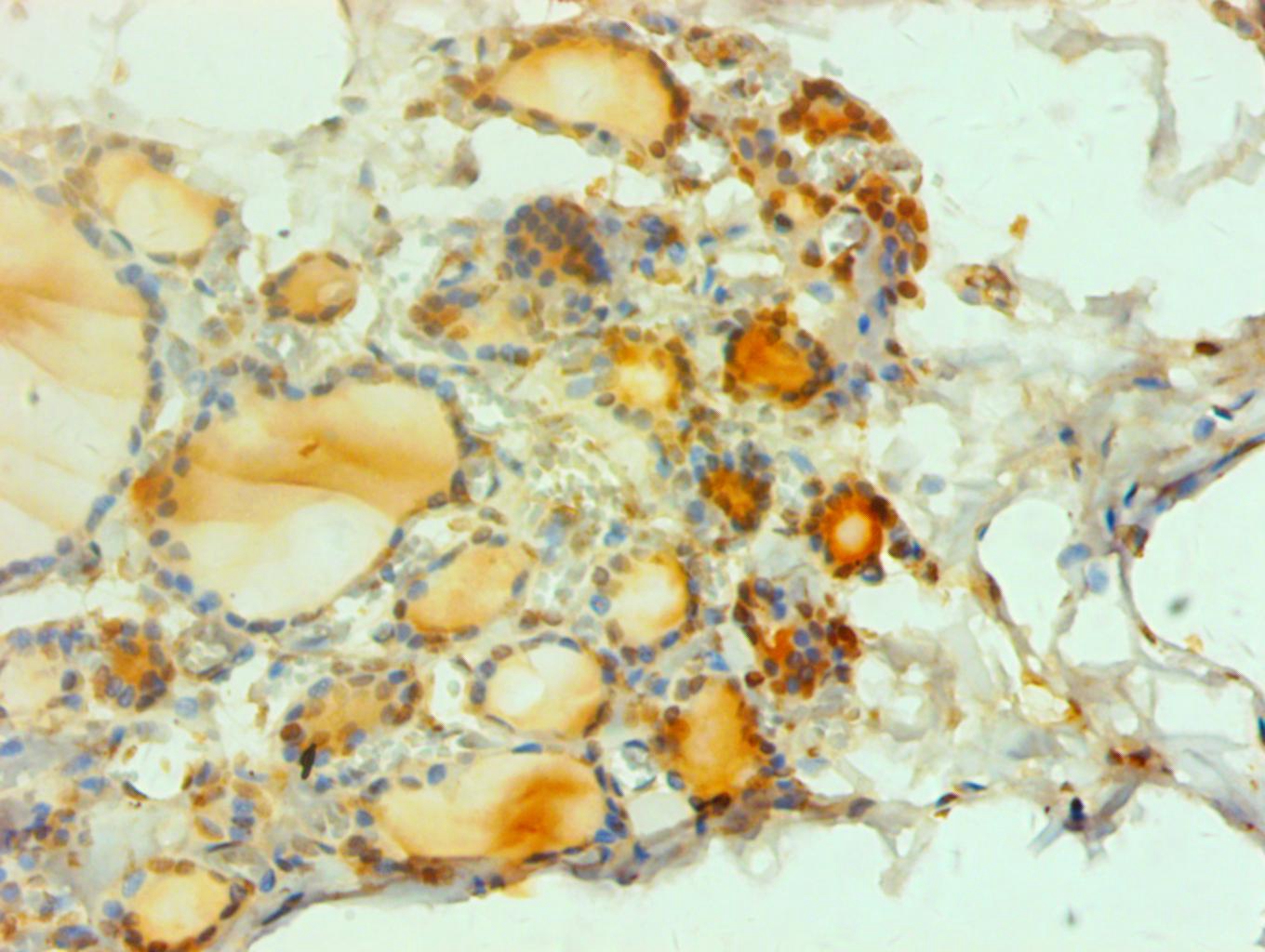 proCalcitonin(PCT) Monoclonal Antibody