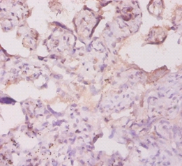 human Protein AMBP Polyclonal Antibody