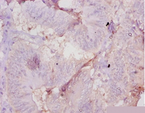 Muellerian-inhibiting factor Polyclonal Antibody