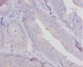 Aldehyde oxidase Polyclonal Antibody