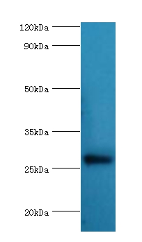 NAA10 Polyclonal Antibody