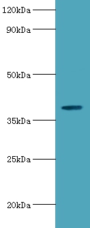 Arylsulfatase B Polyclonal Antibody