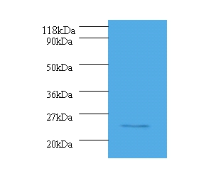 Serine/arginine-rich splicing factor 9 Polyclonal Antibody