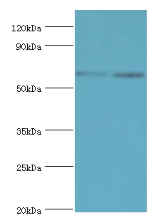 ASMTL Polyclonal Antibody