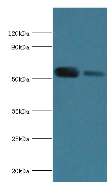 ATP6V1B1 Polyclonal Antibody