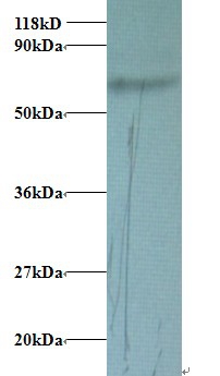 Transferrin Polyclonal Antibody