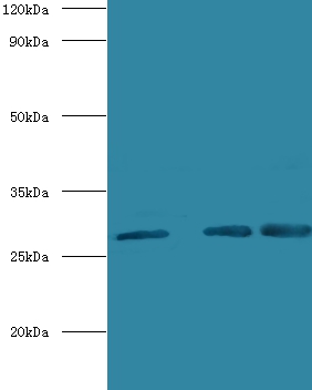 Carbonic anhydrase 1 Polyclonal Antibody