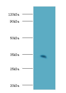 H-2 class II histocompatibility antigen gamma chain Polyclonal Antibody