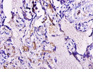 Cyclin-dependent kinase 2-associated protein 1 Polyclonal Antibody