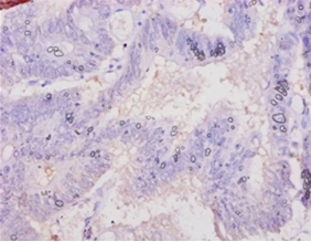 Chromogranin-A Polyclonal Antibody