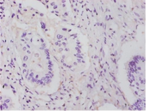 60S ribosomal protein L14 Polyclonal Antibody