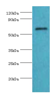 COL10A1 Polyclonal Antibody