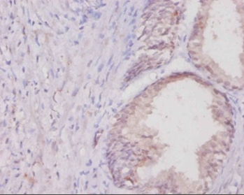 Collagen alpha(I) chain Polyclonal Antibody