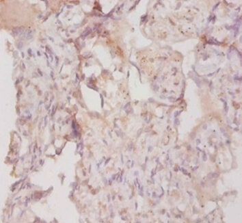 Collagen alpha-3(IV) chain Polyclonal Antibody