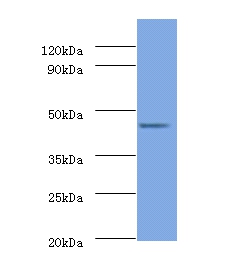 26S proteasome non-ATPase regulatory subunit 11 Polyclonal Antibody