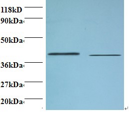 Beta,4-galactosyltransferase 3 Polyclonal Antibody