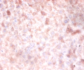 DNA (cytosine-5) methyltransferase3A Polyclonal Antibody
