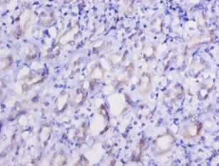 Elongation factor 2 Polyclonal Antibody
