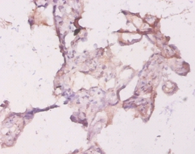 Transforming protein RhoA Polyclonal Antibody