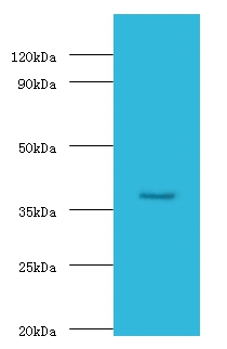 Galactose-phosphate uridylyltransferase Polyclonal Antibody