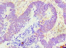 GDF5 Polyclonal Antibody