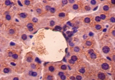 Growth/differentiation factor 5 Polyclonal Antibody
