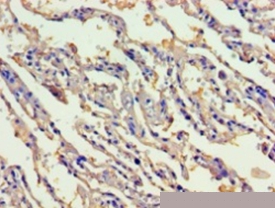 Gastric intrinsic factor Polyclonal Antibody
