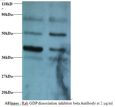 Rab GDP dissociation inhibitor beta Polyclonal Antibody