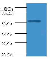 Glucagon-like peptide 1 receptor Polyclonal Antibody