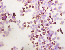 Integrin-linked protein kinase Polyclonal Antibody